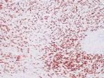SOX-10 Antibody in Immunohistochemistry (Paraffin) (IHC (P))