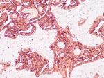 Napsin-A Antibody in Immunohistochemistry (Paraffin) (IHC (P))