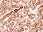 EP-CAM Antibody in Immunohistochemistry (Paraffin) (IHC (P))