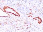 Calponin-1 Antibody in Immunohistochemistry (Paraffin) (IHC (P))