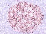 BCL-6 Antibody in Immunohistochemistry (Paraffin) (IHC (P))
