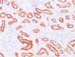 CA IX Antibody in Immunohistochemistry (Paraffin) (IHC (P))