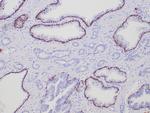 Cytokeratin 5/6 Antibody in Immunohistochemistry (Paraffin) (IHC (P))