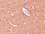 NSE Antibody in Immunohistochemistry (Paraffin) (IHC (P))