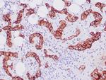 Mesothelin Antibody in Immunohistochemistry (Paraffin) (IHC (P))