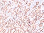 Beta-catenin Antibody in Immunohistochemistry (Paraffin) (IHC (P))
