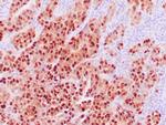 PAX-8 Antibody in Immunohistochemistry (Paraffin) (IHC (P))