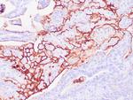 CA125 / MUC16 Antibody in Immunohistochemistry (Paraffin) (IHC (P))