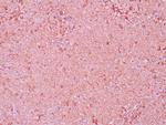 NGFR Antibody in Immunohistochemistry (Paraffin) (IHC (P))