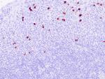 IgG4 Antibody in Immunohistochemistry (Paraffin) (IHC (P))