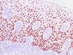 SOX-2 Antibody in Immunohistochemistry (Paraffin) (IHC (P))