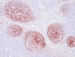 CD21 Antibody in Immunohistochemistry (Paraffin) (IHC (P))