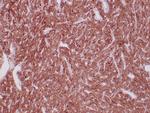 ALDH1A1 Antibody in Immunohistochemistry (Paraffin) (IHC (P))