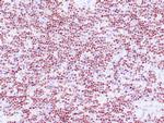 TdT Antibody in Immunohistochemistry (Paraffin) (IHC (P))