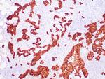 Calretinin Antibody in Immunohistochemistry (Paraffin) (IHC (P))