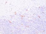 Factor VIII-R Ag Antibody in Immunohistochemistry (Paraffin) (IHC (P))