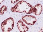 NKX3.1 Antibody in Immunohistochemistry (Paraffin) (IHC (P))
