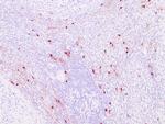 Tryptase Antibody in Immunohistochemistry (Paraffin) (IHC (P))
