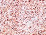 ACTH Antibody in Immunohistochemistry (Paraffin) (IHC (P))