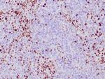 MSH-6 Antibody in Immunohistochemistry (Paraffin) (IHC (P))