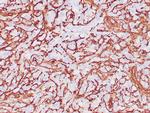 Collagen IV Antibody in Immunohistochemistry (Paraffin) (IHC (P))