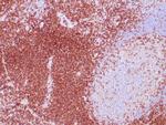 CD4 Antibody in Immunohistochemistry (Paraffin) (IHC (P))
