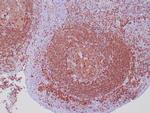 CD79a Antibody in Immunohistochemistry (Paraffin) (IHC (P))