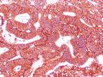 EP-CAM Antibody in Immunohistochemistry (Paraffin) (IHC (P))