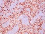 Fascin Antibody in Immunohistochemistry (Paraffin) (IHC (P))