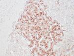 Glypican 3 Antibody in Immunohistochemistry (Paraffin) (IHC (P))