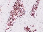 Myogenin Antibody in Immunohistochemistry (Paraffin) (IHC (P))