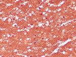 PGP9.5 Antibody in Immunohistochemistry (Paraffin) (IHC (P))