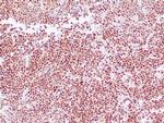 Cyclin D1 Antibody in Immunohistochemistry (Paraffin) (IHC (P))