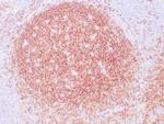 CD19 Antibody in Immunohistochemistry (Paraffin) (IHC (P))