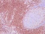 CD4 Antibody in Immunohistochemistry (Paraffin) (IHC (P))