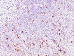TRAcP Antibody in Immunohistochemistry (Paraffin) (IHC (P))