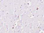Ubiquitin Antibody in Immunohistochemistry (Paraffin) (IHC (P))