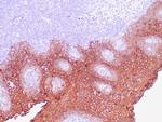 Cytokeratin 5 Antibody in Immunohistochemistry (Paraffin) (IHC (P))