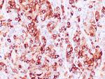 Mammaglobin A Antibody in Immunohistochemistry (Paraffin) (IHC (P))