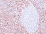 Cyclin D1 Antibody in Immunohistochemistry (Paraffin) (IHC (P))