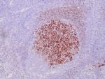 CD23 Antibody in Immunohistochemistry (Paraffin) (IHC (P))