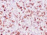 Prolactin Antibody in Immunohistochemistry (Paraffin) (IHC (P))