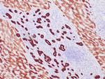 Cytokeratin, Pan Antibody in Immunohistochemistry (Paraffin) (IHC (P))