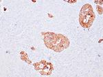 Cytokeratin 18 Antibody in Immunohistochemistry (Paraffin) (IHC (P))