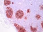 CD23 Antibody in Immunohistochemistry (Paraffin) (IHC (P))