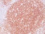CD19 Antibody in Immunohistochemistry (Paraffin) (IHC (P))