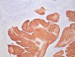 p16INK4a Antibody in Immunohistochemistry (Paraffin) (IHC (P))