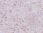 MyoD1 Antibody in Immunohistochemistry (Paraffin) (IHC (P))