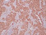 OCT-4 Antibody in Immunohistochemistry (Paraffin) (IHC (P))