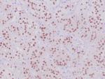 Steroidogenic Factor-1 Antibody in Immunohistochemistry (Paraffin) (IHC (P))